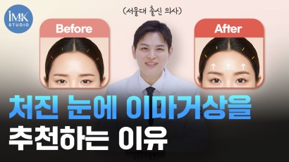최신 성형 트렌드 이마거상