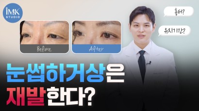 늙는것도 서러운데... 재수술은 너무…