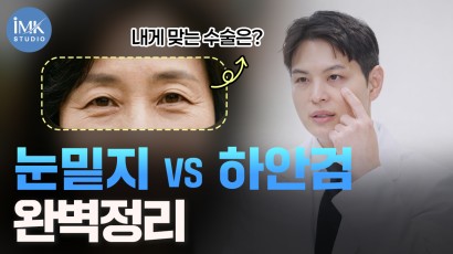 저 눈밑지인가요 하안검인가요?